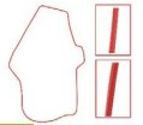 SPI - SPI Chaincase Gasket - SM-03129